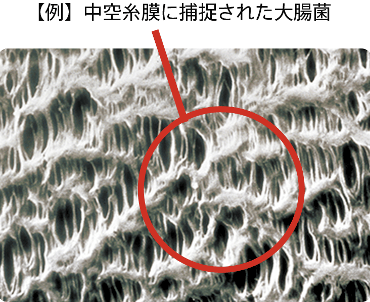 中空糸膜に捕捉された大腸菌